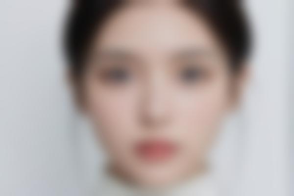 为什么说陈艳医生修复好？