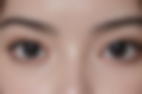汇美整形幼态脸成效自然持久
