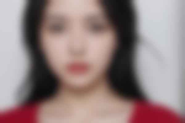 为什么说晶医生做整形自然度很高？