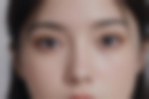 潘彦龙做双眼皮能有多自然？
