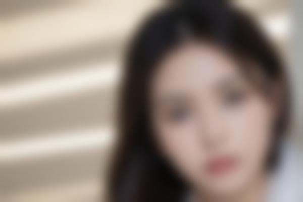 潘彦龙双眼皮修复价格贵吗？